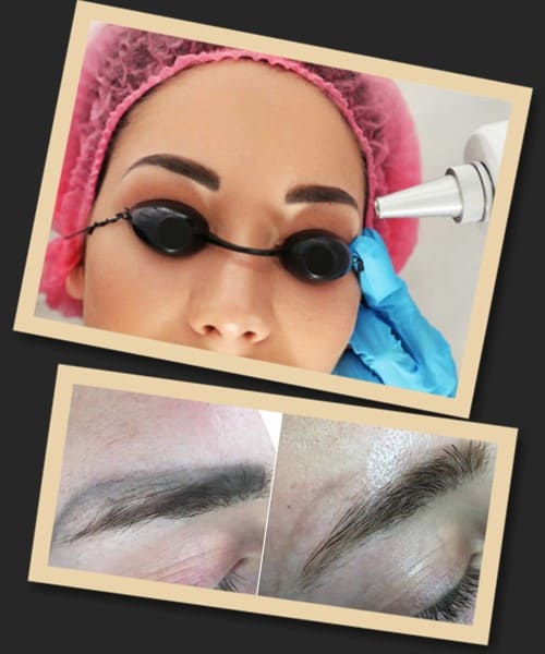 Перманентний макіяж брів видаляють