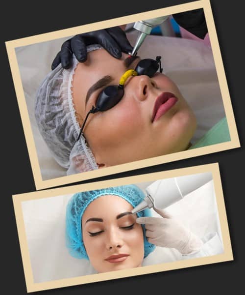 Вивести старий татуаж брів