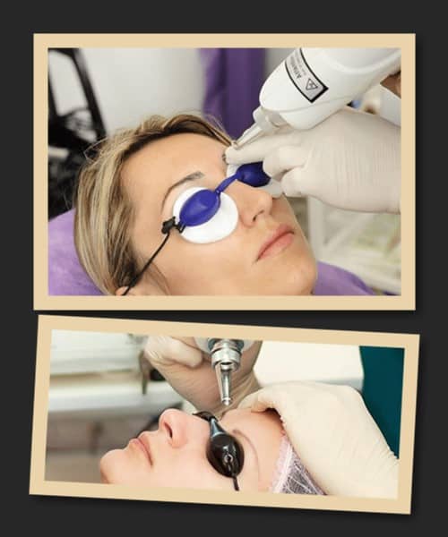 вивести татуаж очей