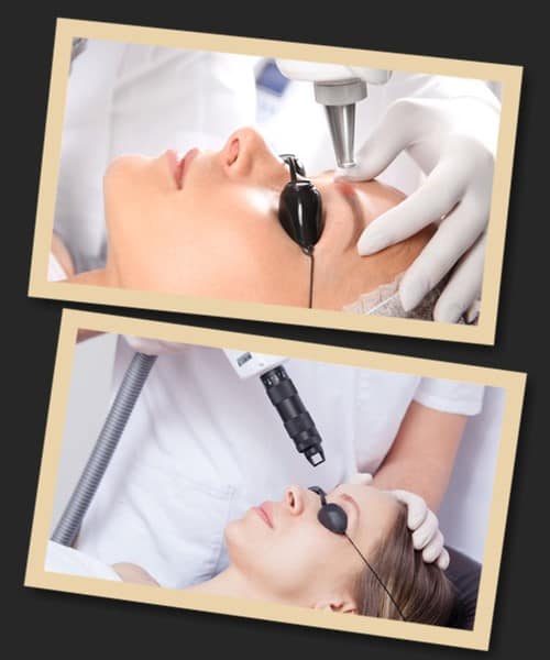 вивести старий татуаж брів