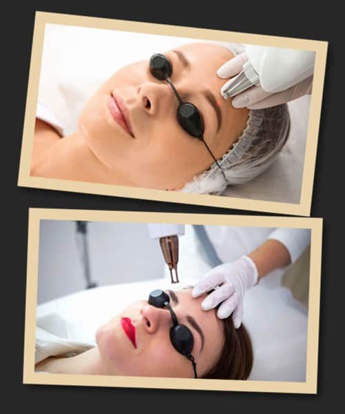 Лазерне виведення перманентного макіяжу брів