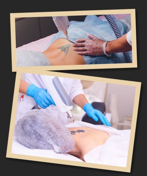 Як вивести свіже татуювання