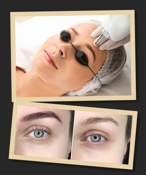 Способи виправлення татуажу брів