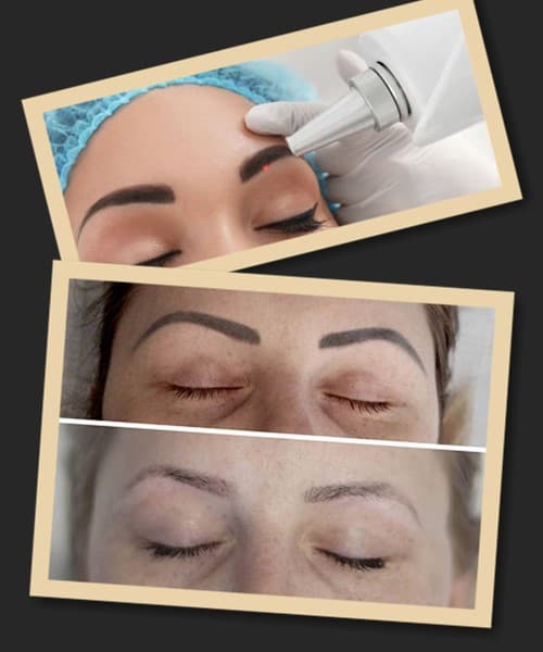 виправлення татуажу брів