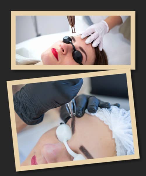 Як виправити татуаж брів?