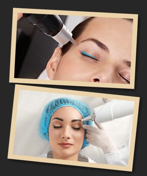 Як виправити татуаж