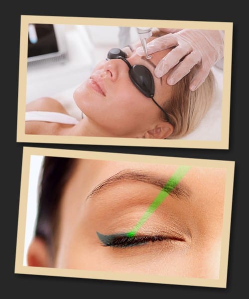 Методи виправлення татуажу