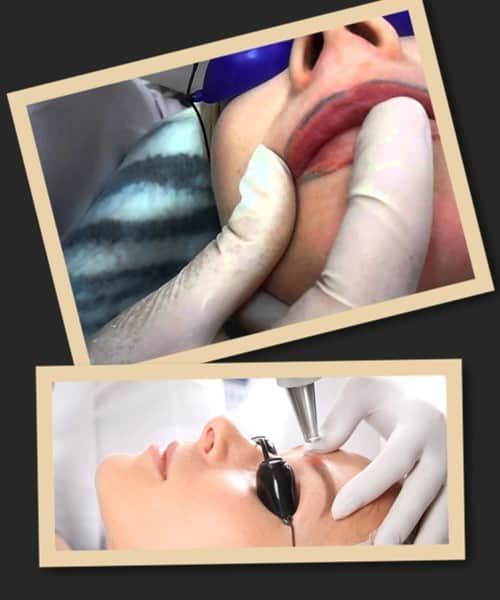 Сколько времени займет исправление татуажа