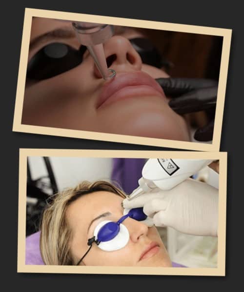 Скільки часу займе виправлення татуажу