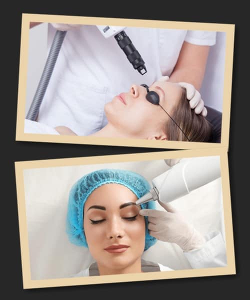 Лазерне видалення татуажу брів: ціна