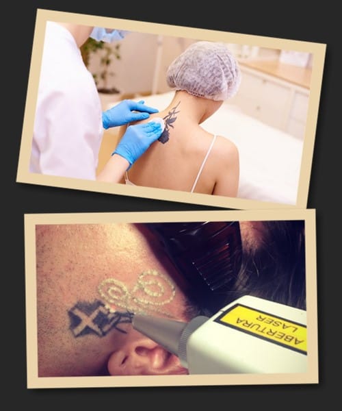 Особливості неодимового лазера