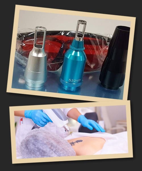 Види лазерів для виведення татуювань