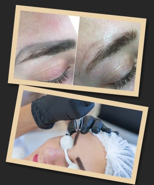 Особливості лазерного методу виведення перманентного макіяжу