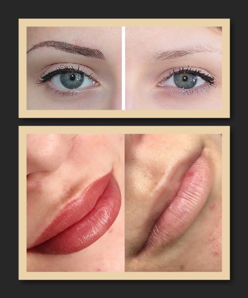 Виведення перманенту за допомогою лазера