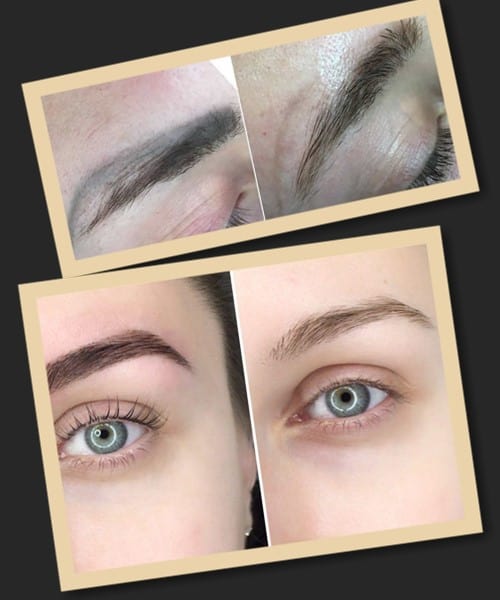 Переваги лазера при виведенні перманентного макіяжу брів