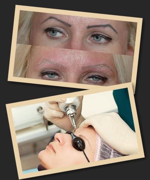 азерне виведення перманентного макіяжу брів