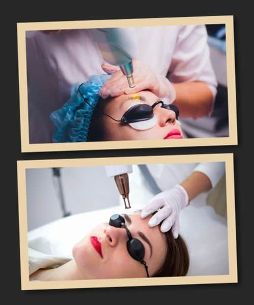 Чи залишаються шрами після видалення татуажу брів