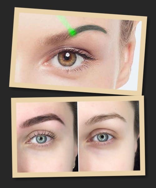 видалення татуажу брів