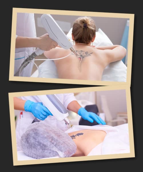 Ціни зведення татуювань