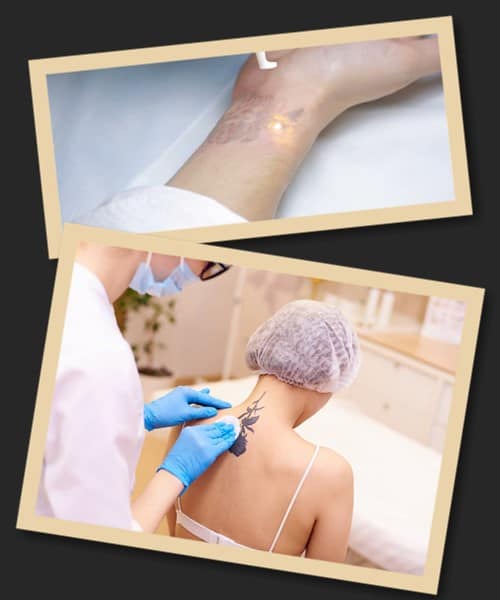 Чому позбавляються від татуювань?