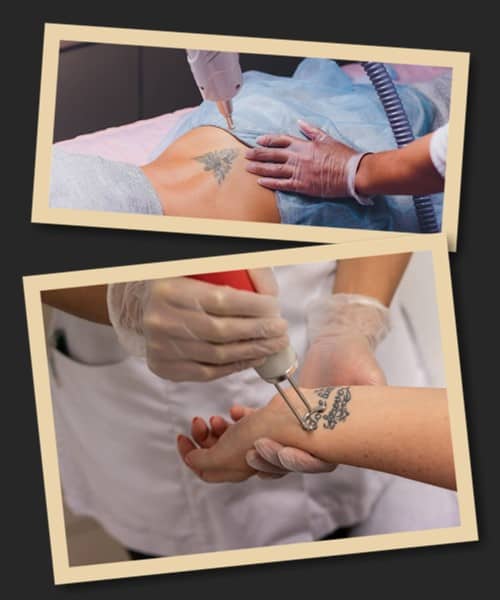 Чому не можна видаляти свіже тату?