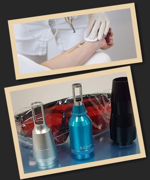 Суть лазерної технології видалення тату