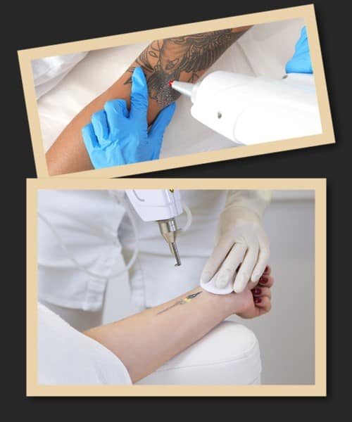 виведення свіжого татуювання