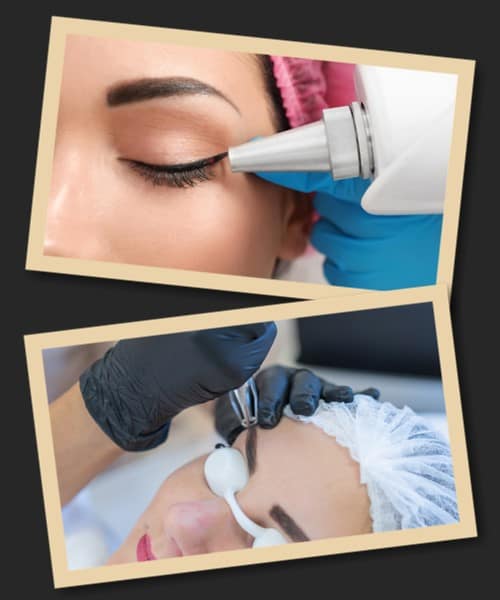 видалення перманентного макіяжу