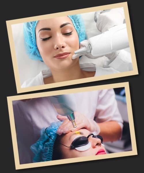 Виправлення неякісного татуажу за допомогою лазерної технології