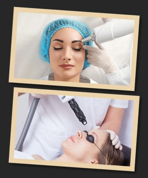 Методи видалення перманентного макіяжу