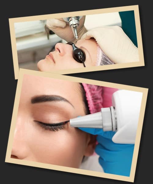 Виправлення татуажу очей