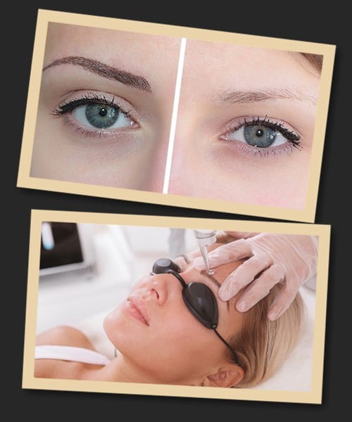 видалення перманентного макіяжу очей у Києві