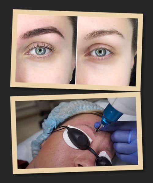 Виправлення татуажу очей