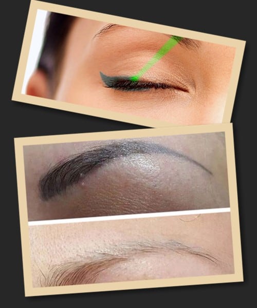 виправлення татуажу очей у Києві