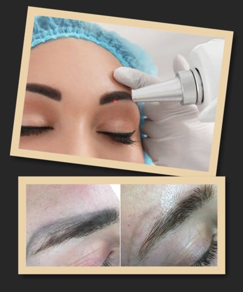 За скільки сеансів можна видалити татуаж брів