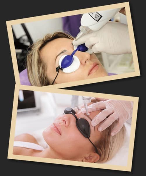 фактори що впливають на швидкість зведення татуажу