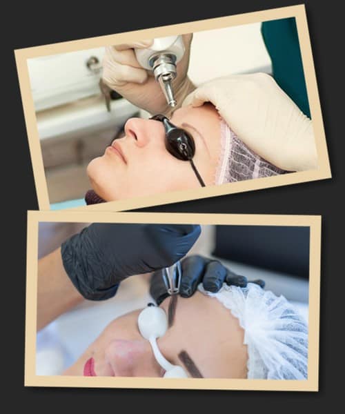 За скільки сеансів можна видалити татуаж