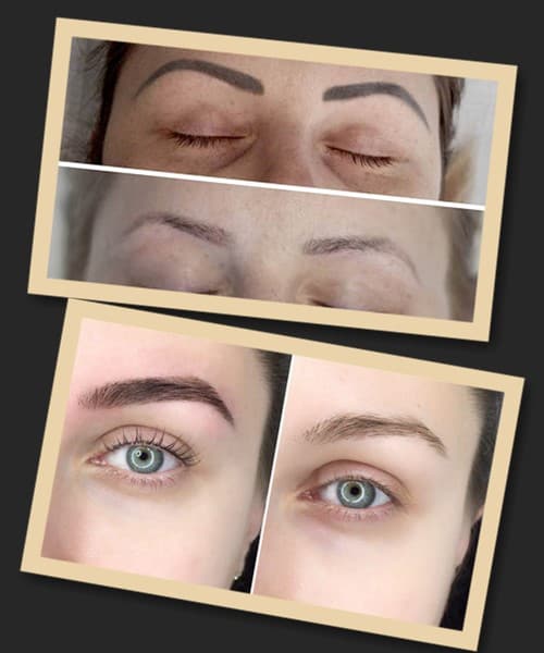 Як виглядають брови після видалення татуажу