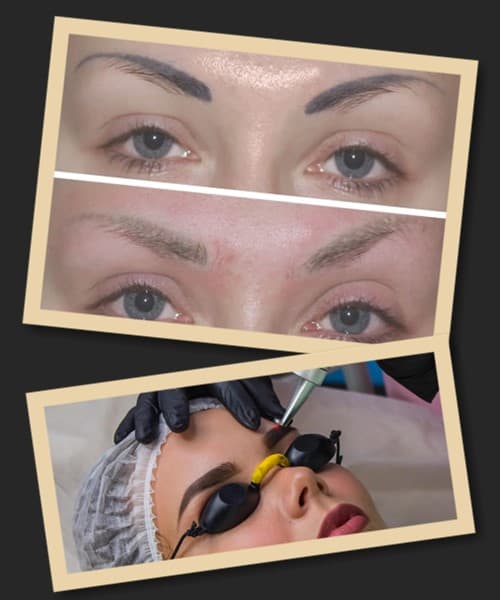 Як видалити старий татуаж брів