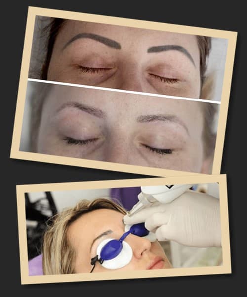 видалити перманентний макіяж брів