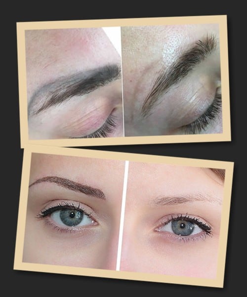 виведення застарілого татуажу