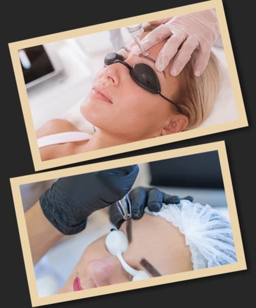 видалити пудровий татуаж брів