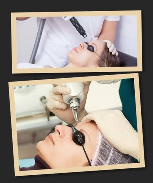 виведення татуажу брів