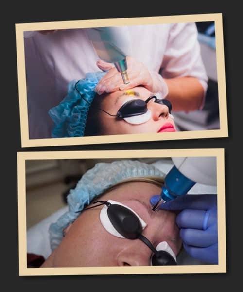 видаляти свіжий татуаж