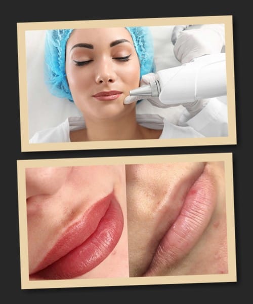 Як виправити татуаж губ