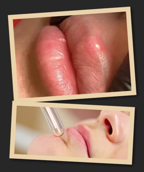 видаляти татуаж губ