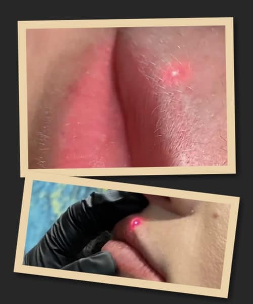 Позбавитися від перманентного макіяжу в Києві