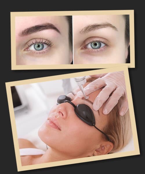 виведення небажаного перманентного макіяжу