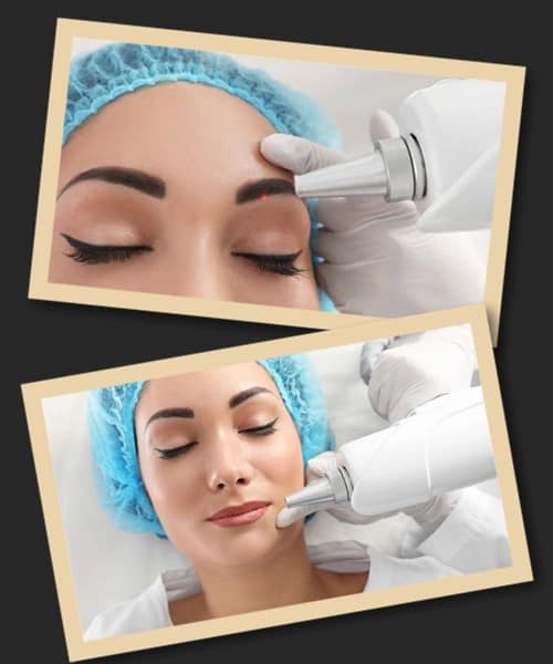 Для повного виведення перманентного макіяжу