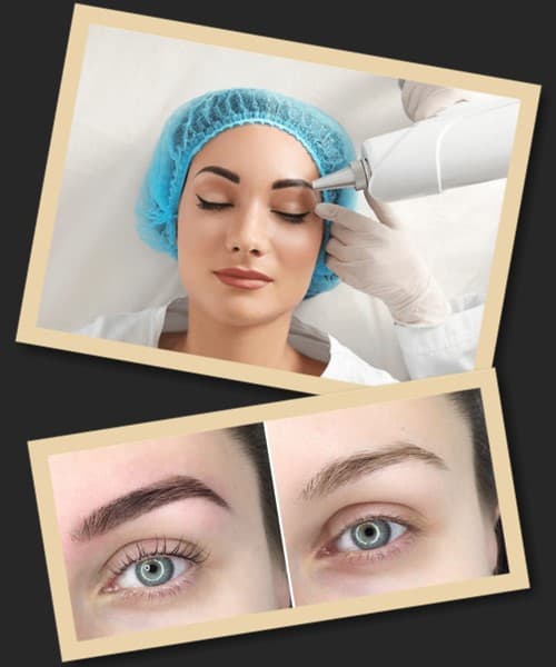 Лазерне видалення татуажу наслідки